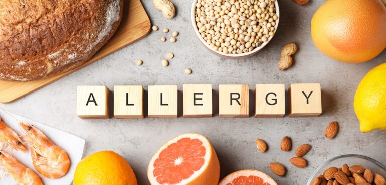 typical foods that create Food allergies